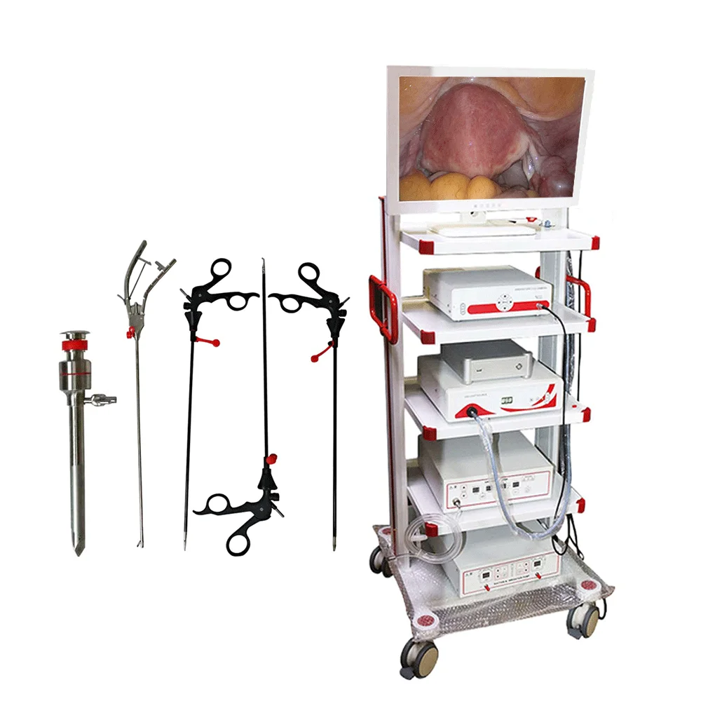 Laparoscopy Equipment 10mm 30 Degrees Laparoscope Trolley Laparoscopic Laparoscopy Machine