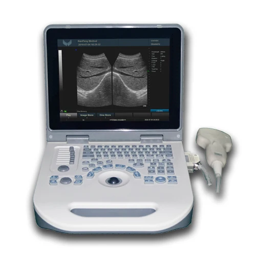 XF50 Full Digital LED Health Treatment Portable Pocket Expert Grade Ultrasound