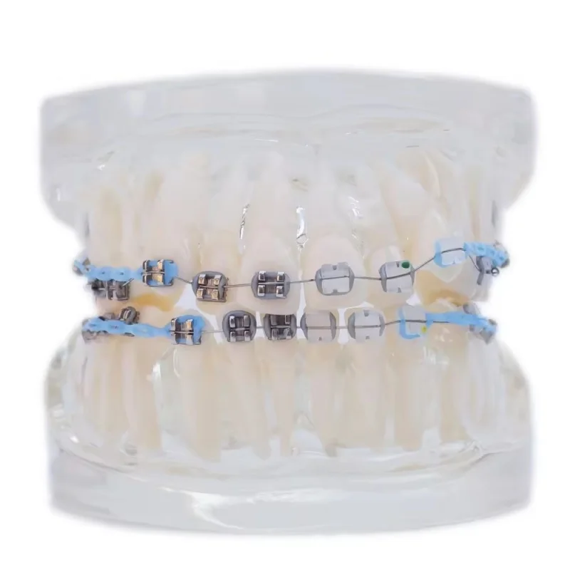 Hot Sell Human Teeth Model for Study Multi Color To Choose with Brackets Dental Teaching School Use Orthodontic Teeth Model
