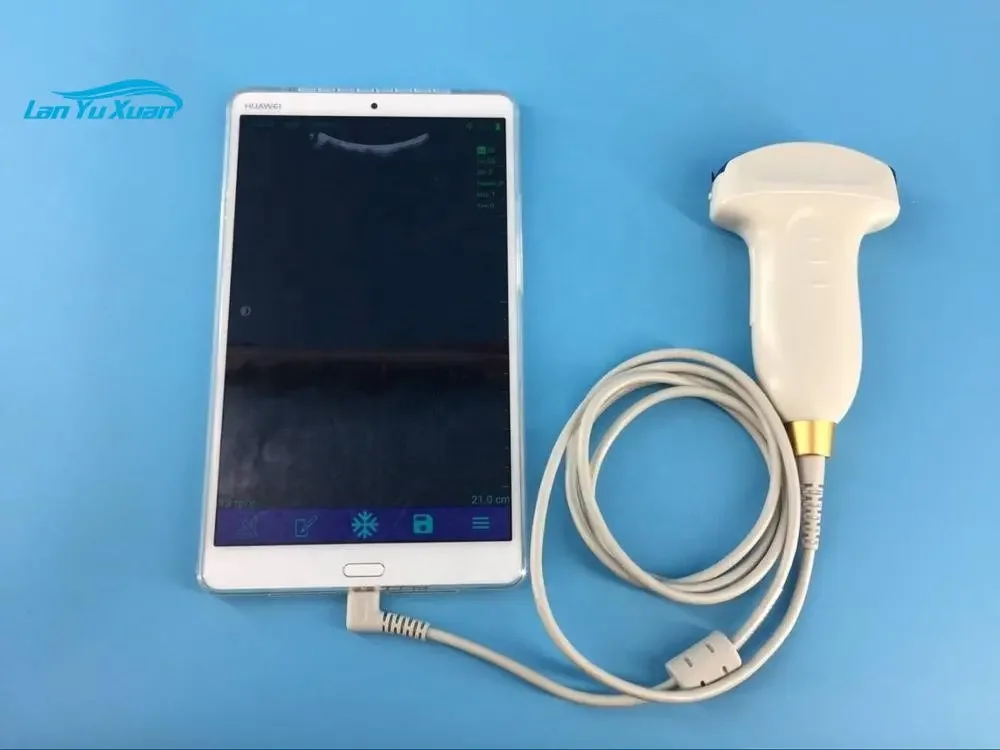 Fast operation USB ultrasound convex linear probe for mobile phone