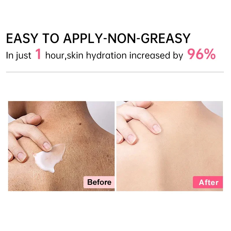 Loción corporal scalane Cloud, loción blanqueadora, hidratante suave, rejuvenecimiento, emoliente, Perfume, sabor, crema para el cuidado de la piel corporal