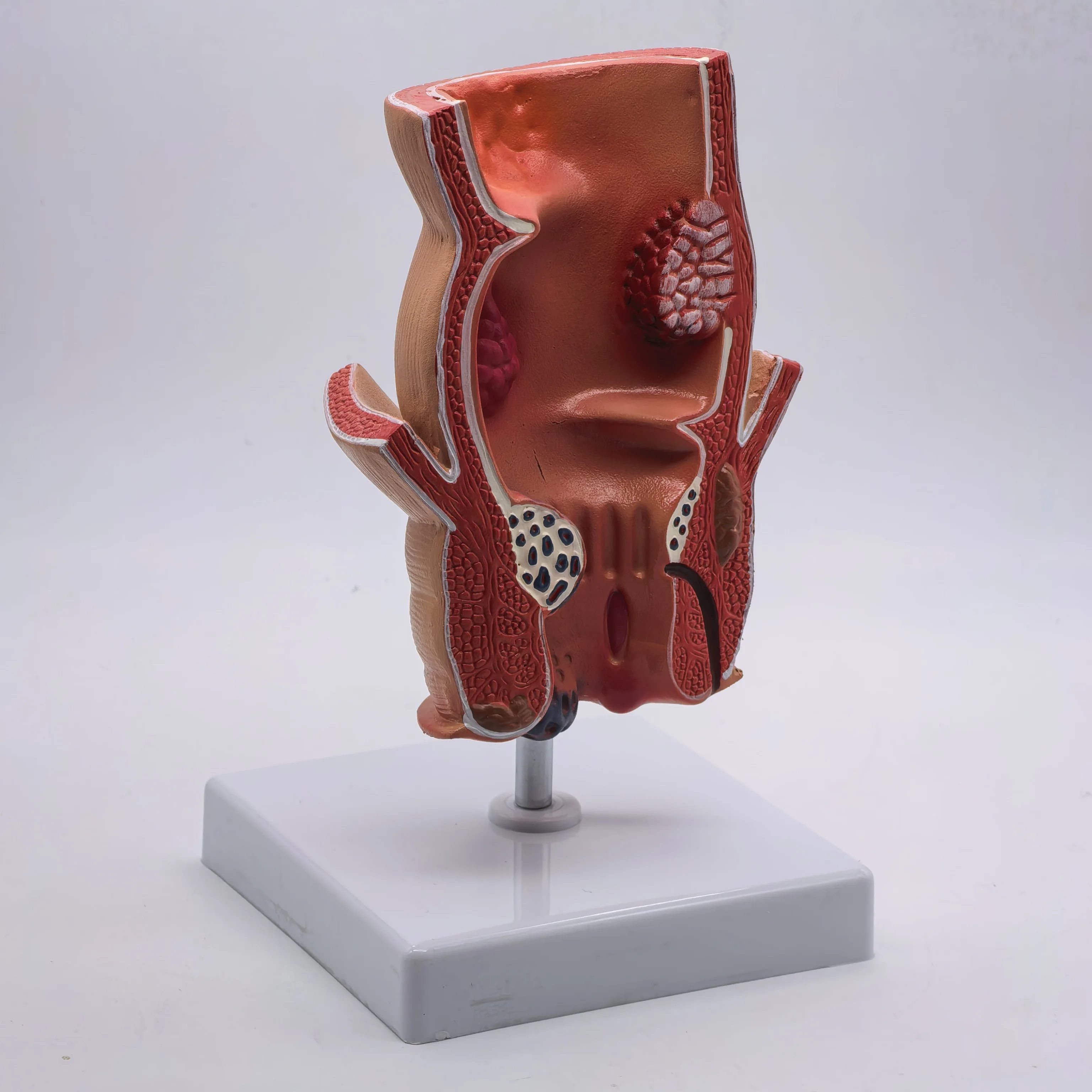 PVC Anatomical Human Rectum Pathology Lesion Model Hemorrhoids Anus Medical Teaching Rectal Learning