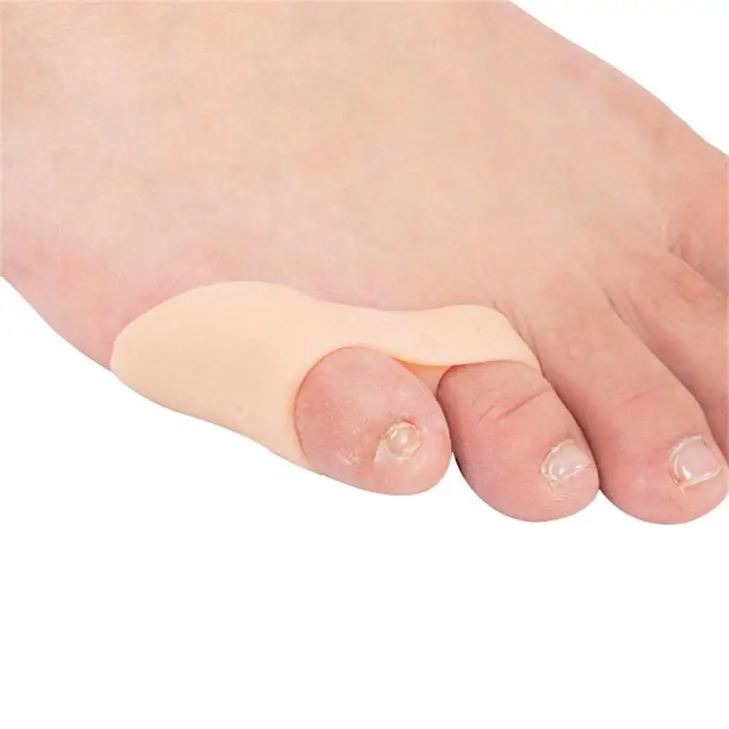 Toe Protector Correction Of Misaligned Toes Prevent Friction Relieve Painful Toes With Silicone Separators Toe Separator Gentle