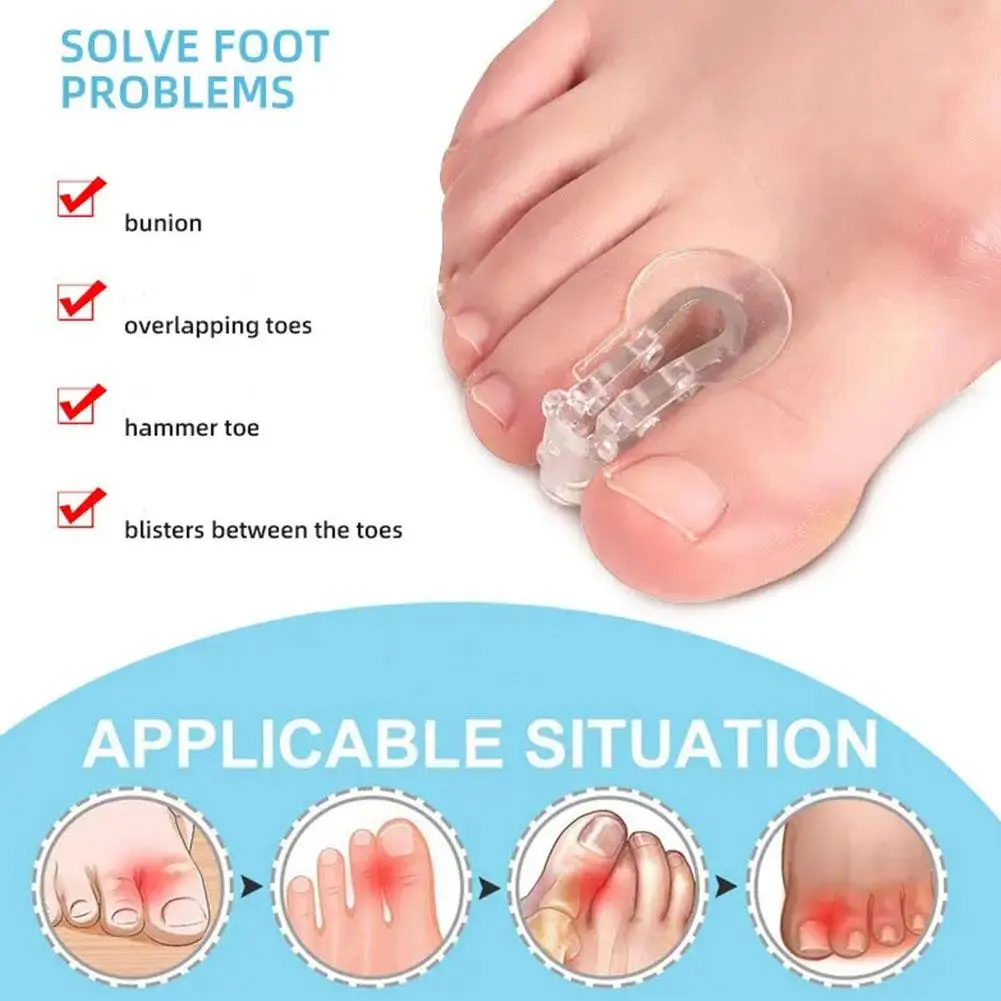 Silicone toe corrector para o dedo do pé, corrector para o corrector do dedo do pé, 2 partes