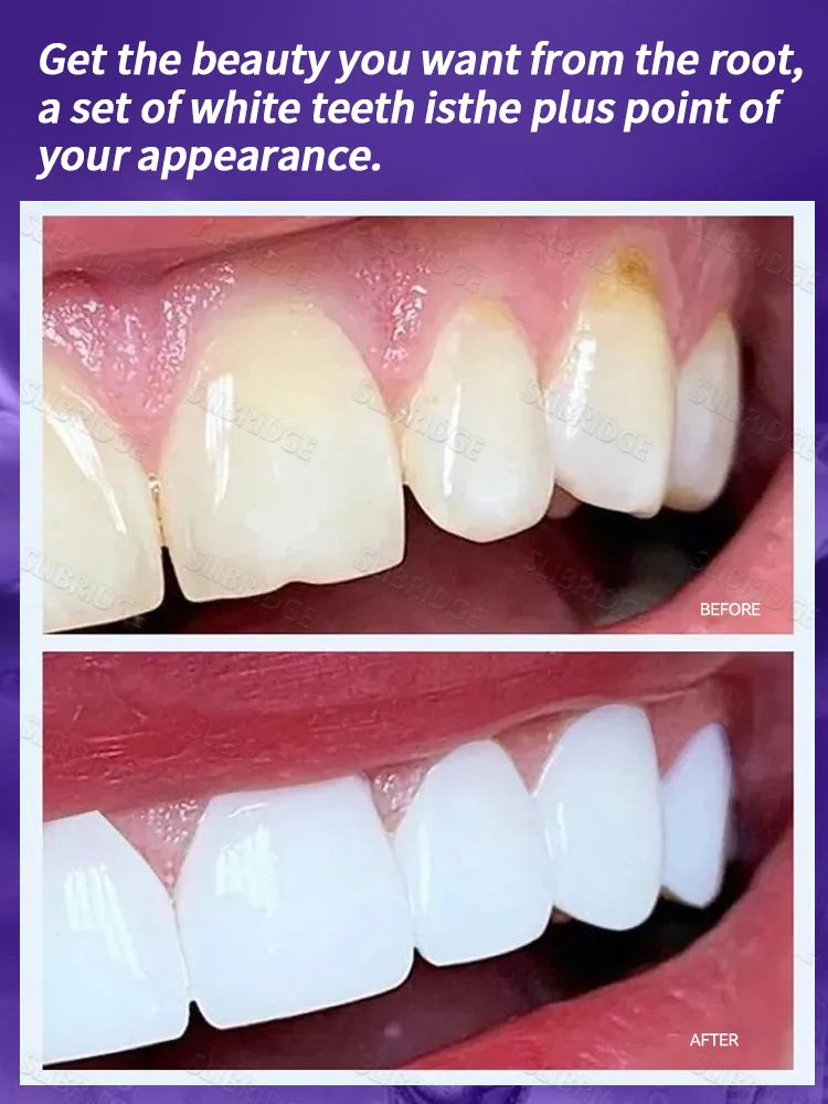 قلم تبييض يحل البقع الصفراء، أدوات العناية بالتبييض، شحن مجاني، أبيض جدًا هو أعمى