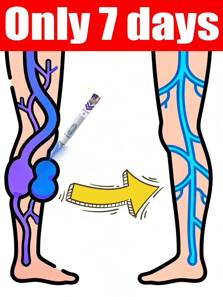 

Lᴀsᴇʀ ɪɴsᴛʀᴜᴍᴇɴᴛ ғᴏʀ ᴠᴀʀɪᴄᴏsᴇ ᴠᴇɪɴ ᴄᴏʀʀᴇᴄᴛɪᴏɴ