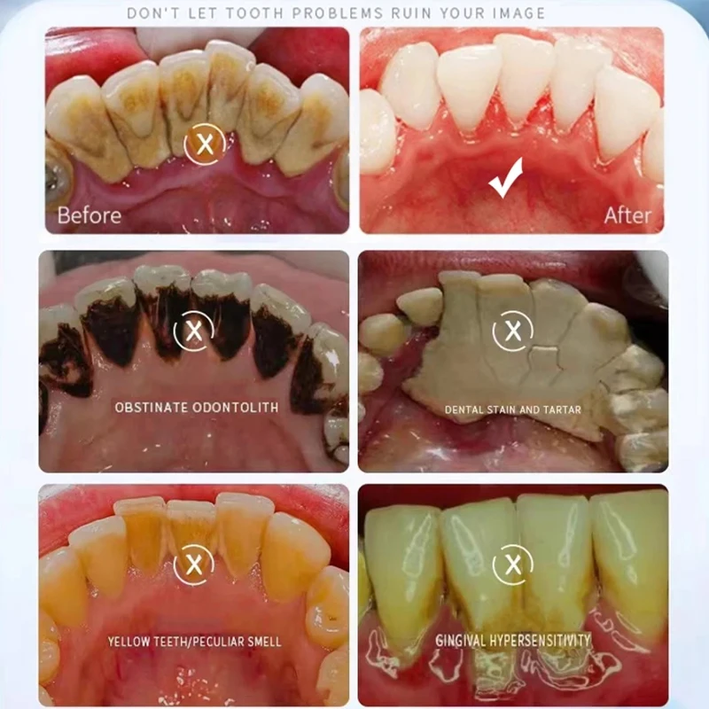 حل علاج فطريات الأظافر ، جوهر إصلاح العناية بالأظافر ، مضاد للعدوى ، فطار الأظافر والأظافر النامية ، إزالة فطريات أصابع القدم