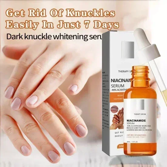 Fast Whitening Serum Hand Knuckle Elbows Knee Melanin Corrector Intense Stains Remover Products Beauty Care