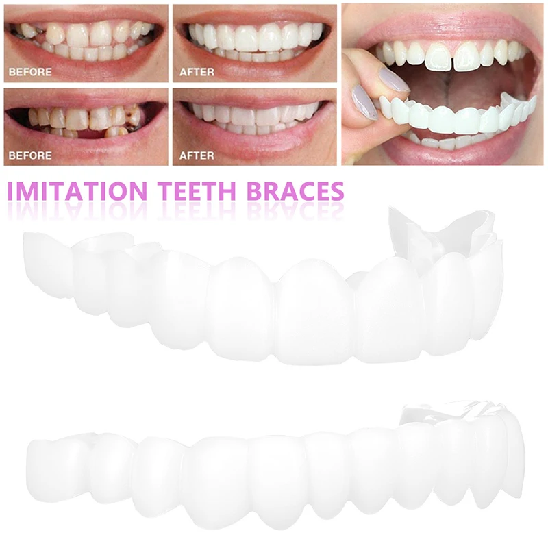 Sdotter 2Pcs/Set Silicone Teeth Whitening Teeth Cover Teeth Braces Simulation Denture Upper Teeth Lower Teeth Set with Box Perfe