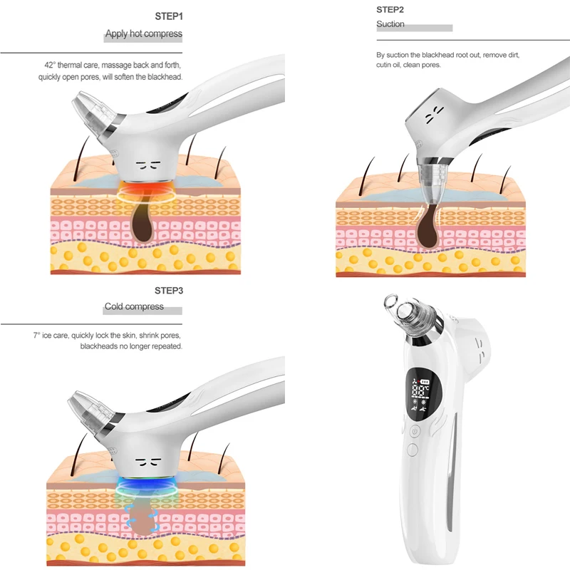 Point Noirs Extracteur Blackhead Remover Vacuum Pore Cleaner Hot Cold Compress Facial Care Tool Pimple Acne Remover Machine