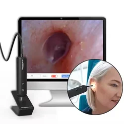 Digital Otoscope 1280P HD Digital Image Capture Ear Scope Endoscope Adjustment Light Intensity Ransfer Files Through Computer