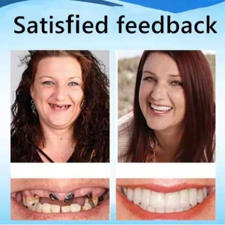 Slim Comfortable Custom Fit Dentures Boil to Shape Fits All Arch Sizes Reliable for Daily Meal Drink