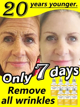 구매 2 개 1 개 무료, 구매 3 개 2 개 무료, 구매 5 개, 구매 10 개, 12 개