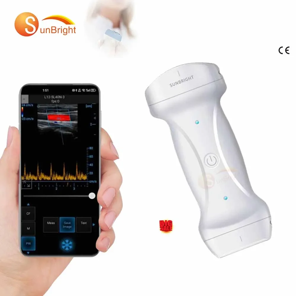 

Medical Wireless Ultrasound Machine Portable Ultrasound Machine Price For Clinic