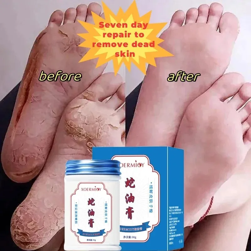 Krim Kaki Herbal Anti retak produk perbaikan tumit retak penghilang kulit mati pengelupasan pelembap perawatan kulit halus