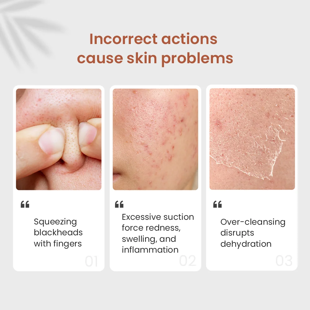 facial ultrasonic cleaner  Deeply clean skin Blackhead Remover Remove dead skin skincare equipment ﻿