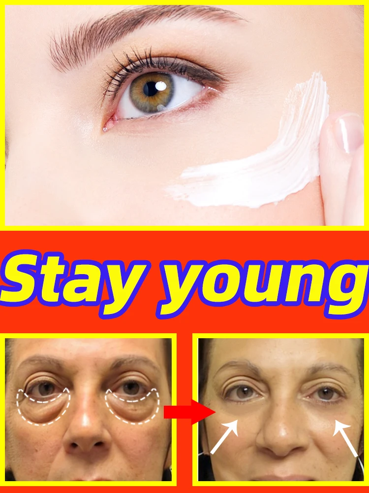 Eye Cream Remove Eye Bags Dark Circles