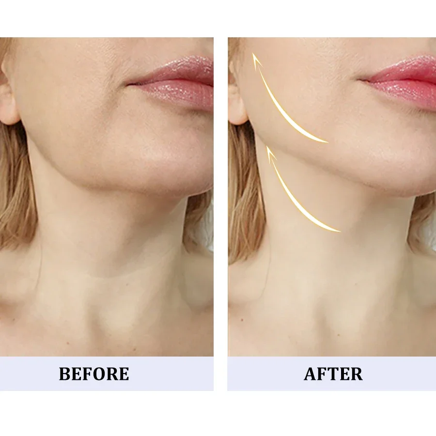 الوجه والرقبة رفع التخسيس هيكسابيبتيد جوهر طقم تجميل مدلك الوجه LED العلاج بالضوء مزيل الذقن المزدوجة الجمال المنزلي