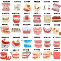 Modelo de dientes dentales, modelos de enseñanza Dental, modelo de implante, modelo de odontología extraíble, dientes para entrenamiento, estudio, educación del paciente