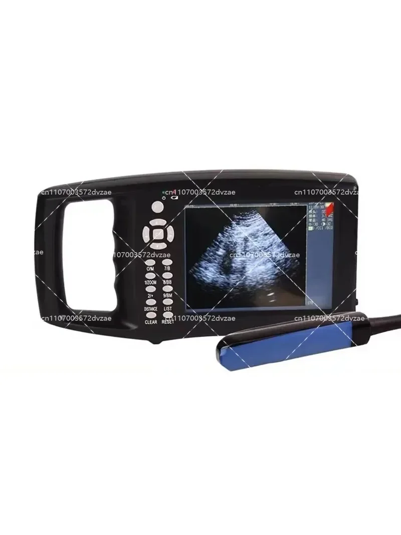 Portable 5.6 Inch Screen Veterinary Ultrasound Scanner for Cow Pig Sheep Horse - Farm Pregnancy Testing Machine