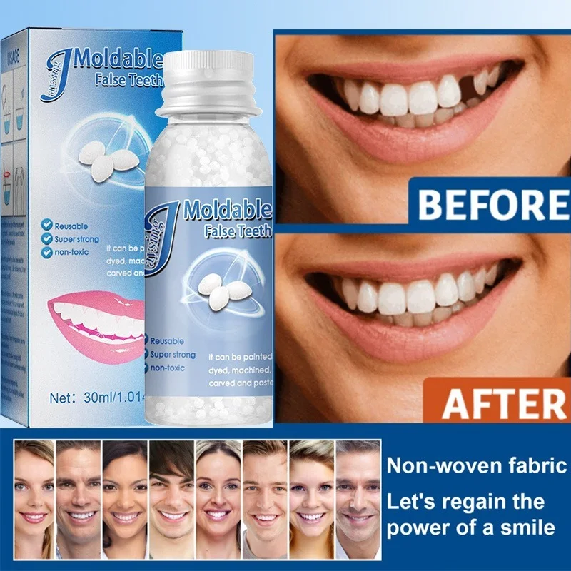 Moldable FalseTeeth Solid Glue Temporary Tooth Repair Granules Filling Tooth Gaps Missing Broken Teeth Adhesive Beauty Tool 30ml