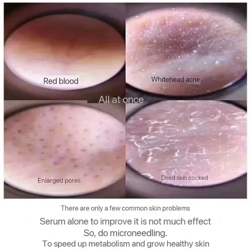 Imagen 2 del producto Esponja de microcristal, polvo liofilizado, regeneración de colágeno, extracto biológico Natural, esponjas, renovación de células de la piel, 10 Uds.