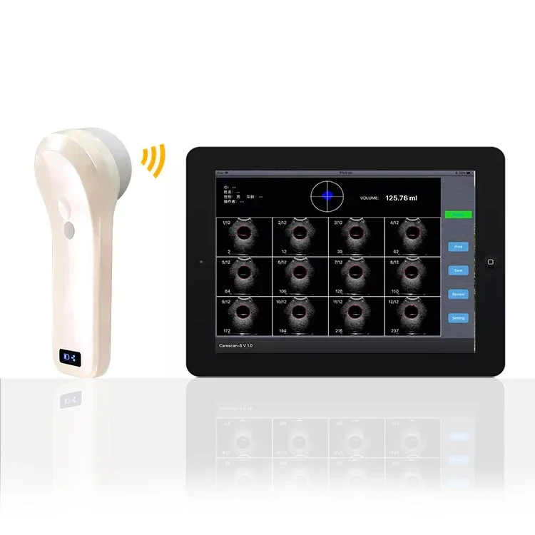 BProbe-2 4D handheld 80 element black and white array scan Wireless Bladder ultrasound Scanner probe