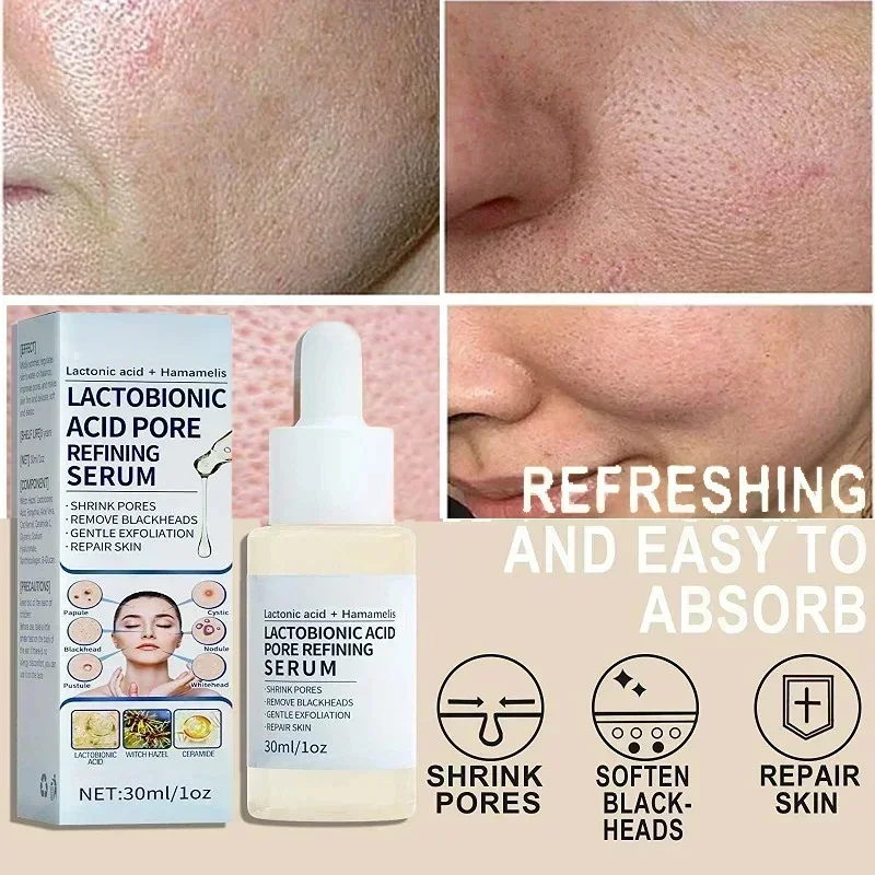 Poro Shrinking Face Serum, Reduz os Poros Grandes, Aperta, Minimiza Facial Purificar, Clareamento Dos Cuidados Com A Pele