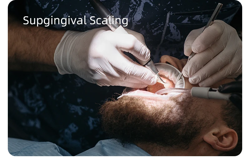 VVDental Ultraschall-Scaler-Maschine mit LED-Licht-Handstück zur Entfernung von Zahnstein und zur Zahnreinigung für Zahnkliniken – Detail 5
