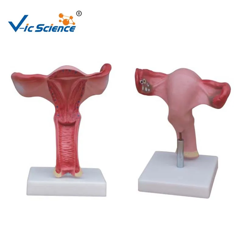 Advanced PVC Made Magnified Uterus Enlarged Model