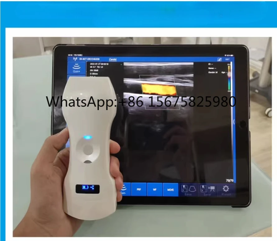 CMS1600B-VET Veterinary USB Color Doppler U ltrasound Diagnostic Scanner for Pets