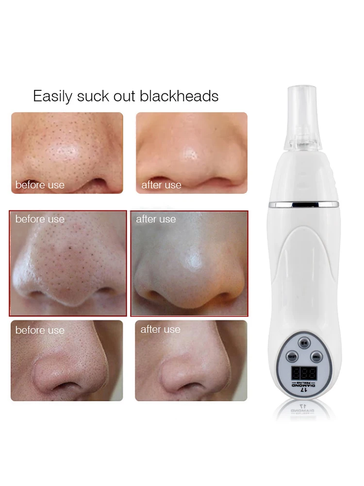 2026 Diamond Microdermabrasion Beauty Device Facial Deep Cleansing Pore Cleaner Handheld Blackhead Removal Skin Care
