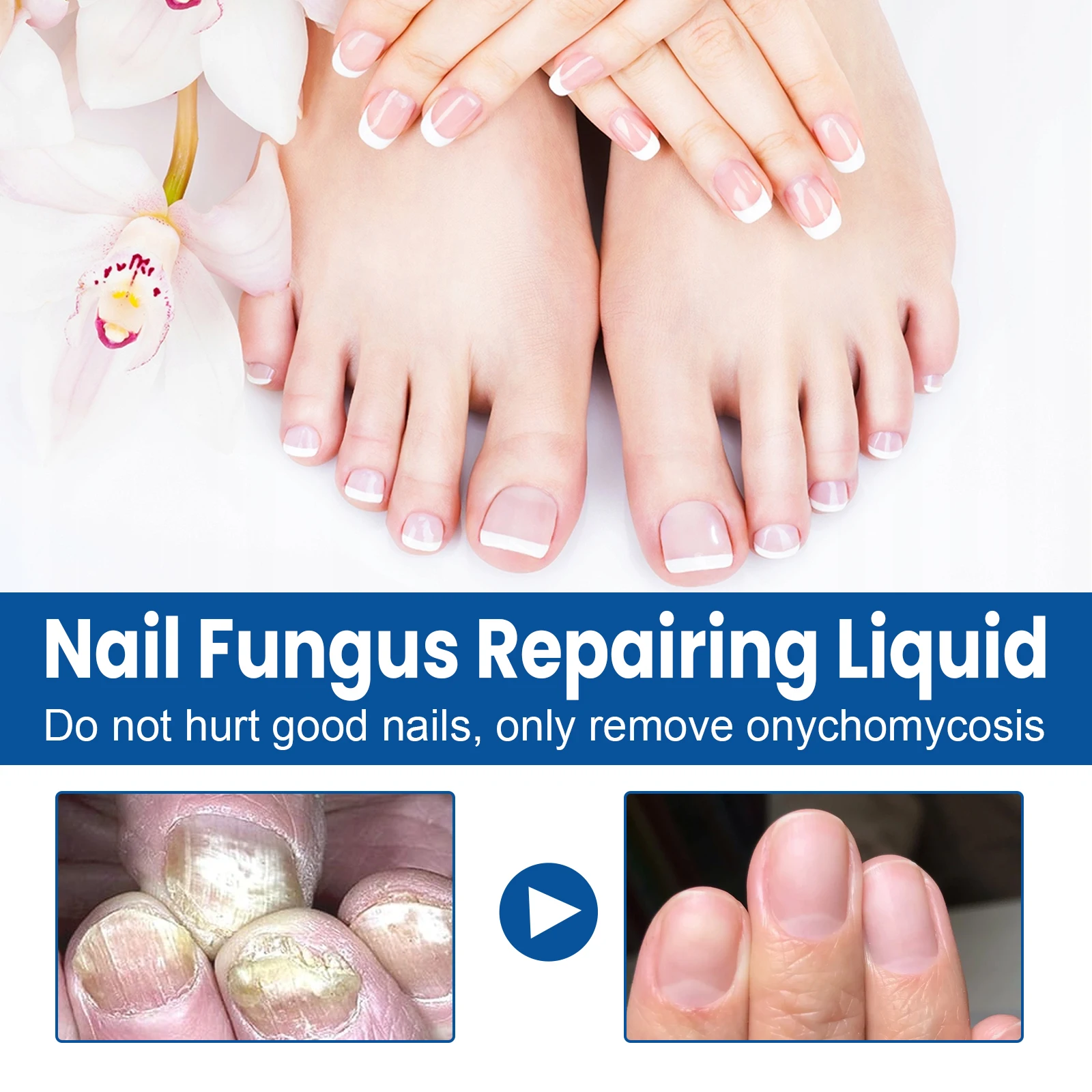 30ml Nail Fungus Repairing Liquid Soothes Softens Moisturizes Nails Deeply Clean Repairs Restores Nail Luster Essential Oils