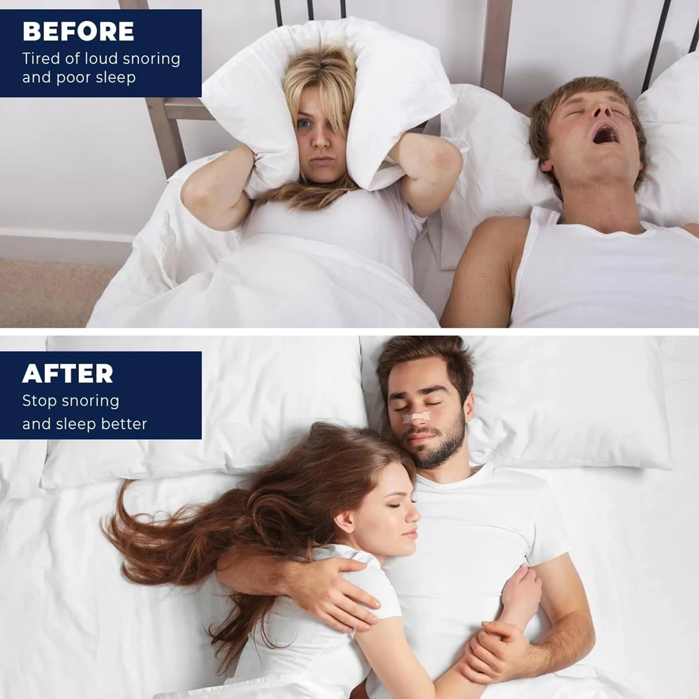 【~ NEW A01R】Nasal Strips for Snoring Improved Airflow Relieve Nasal Congestion Extra Strength Anti Snoring Solution 30 Count