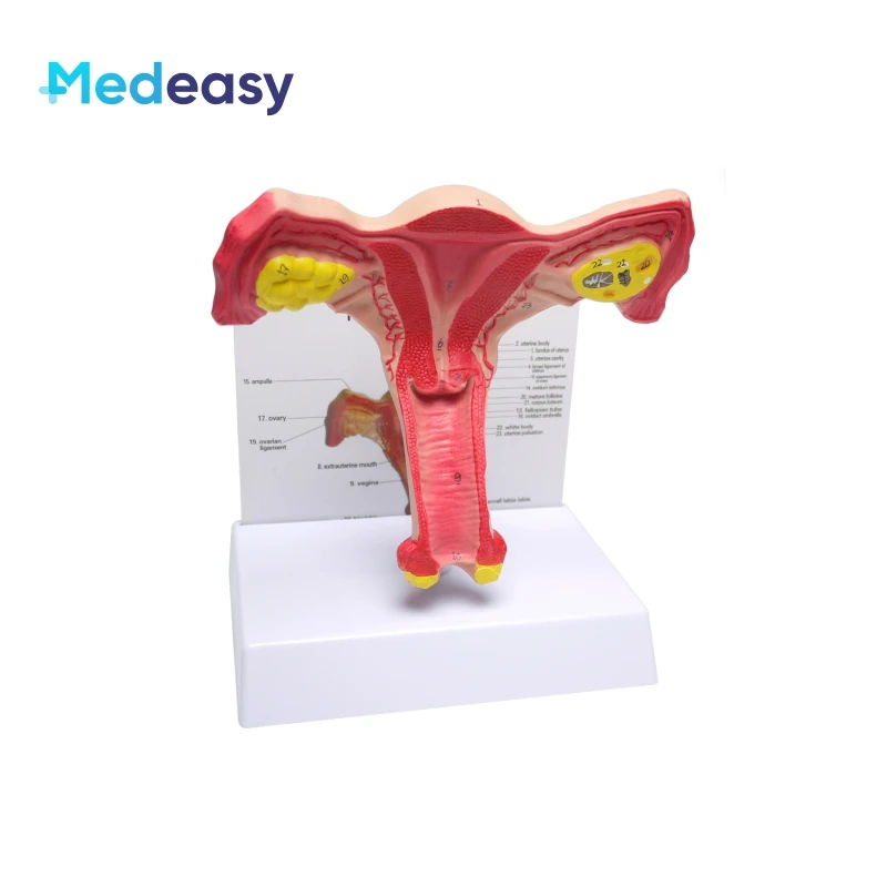 Female Uterus and Ovary Anatomical Model Vagina Model Plastic Uterus Model Normal/Diseased Uterus Model