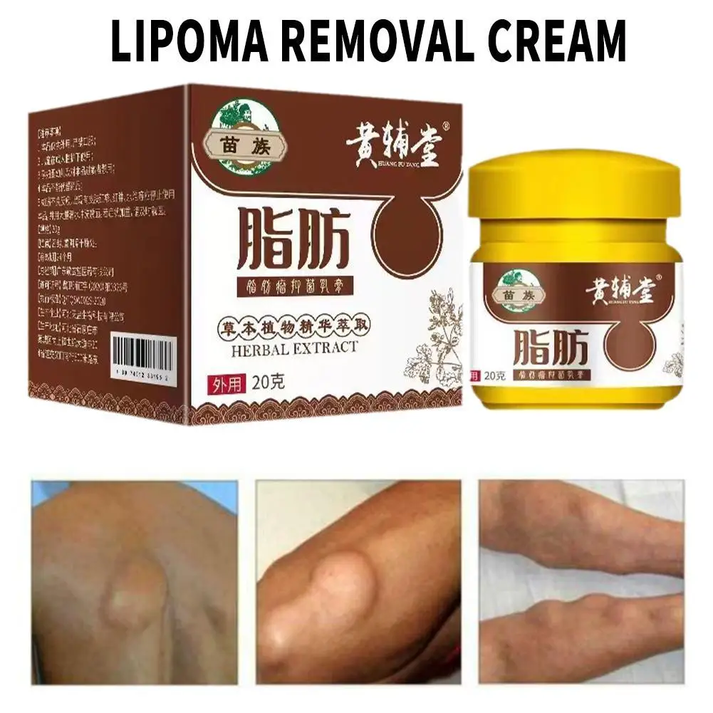 20g Lipoma Remover Treatment Cream Fat Mass Herbal Medicine Plaster Lumps Fibroma Multiple Lipomas Cellulite Body Health Care