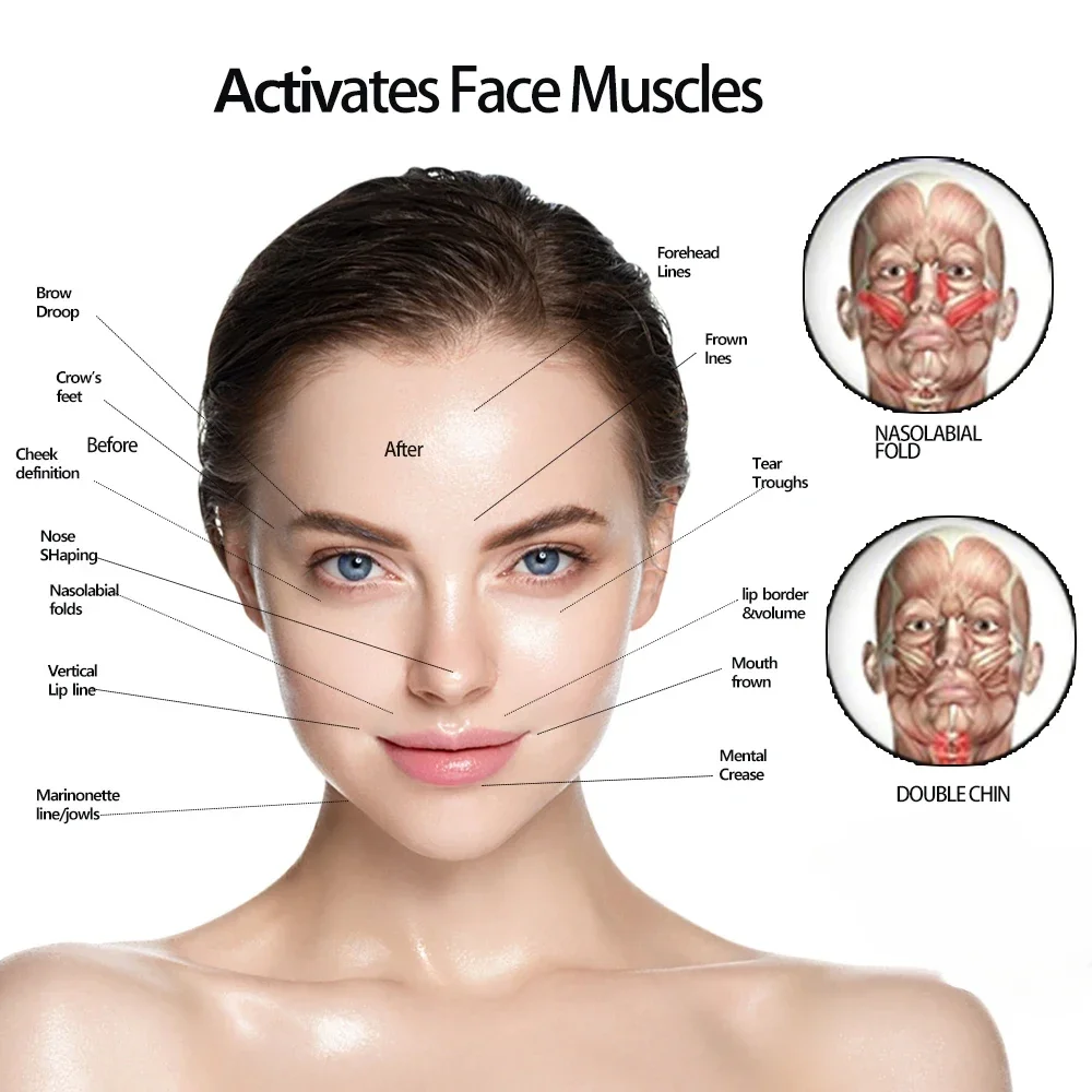 Verbessertes Kiefertrainer und Nackentröner, Jawline Exerciser für Gesicht, Muskeltraining, Doppelkinn-Reduzierer, Gesichts-Schlankheitswerkzeuge, Facelift – Detail 10
