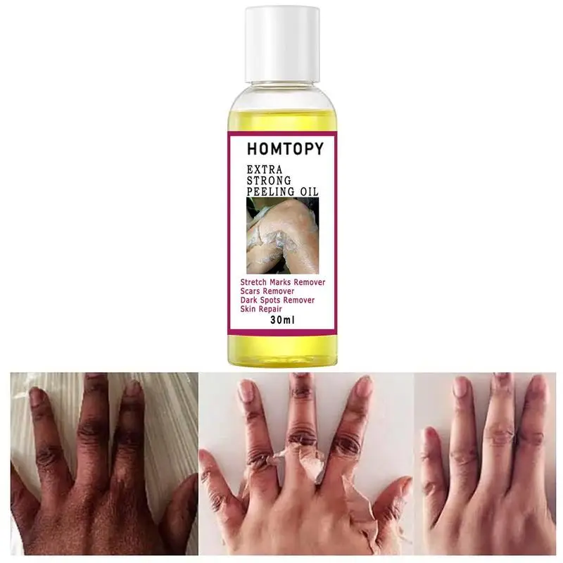 Aceite Peeling para iluminar la piel oscura, Aceite Corporal amarillo y amarillo viejo, aceite Peeling para iluminar la piel, hidratante para la mayoría de la piel