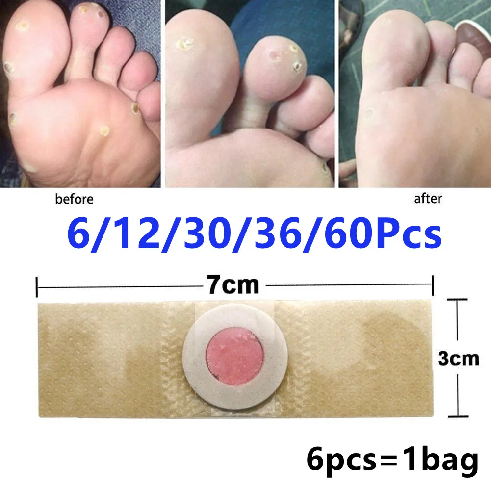 6/12/30/36/60Pcs Fuß Zehe Mais Kallus Entferner Pads Selbst-Stick Klebstoff fuß Kissen Mais Kallus Entferner Kissen Fuß Pflege