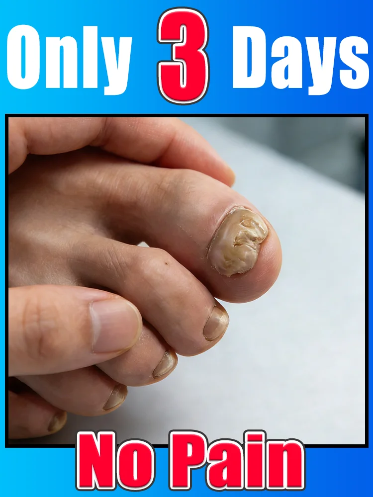 

Break away from rough dull nails, fingertips stay soft glossy