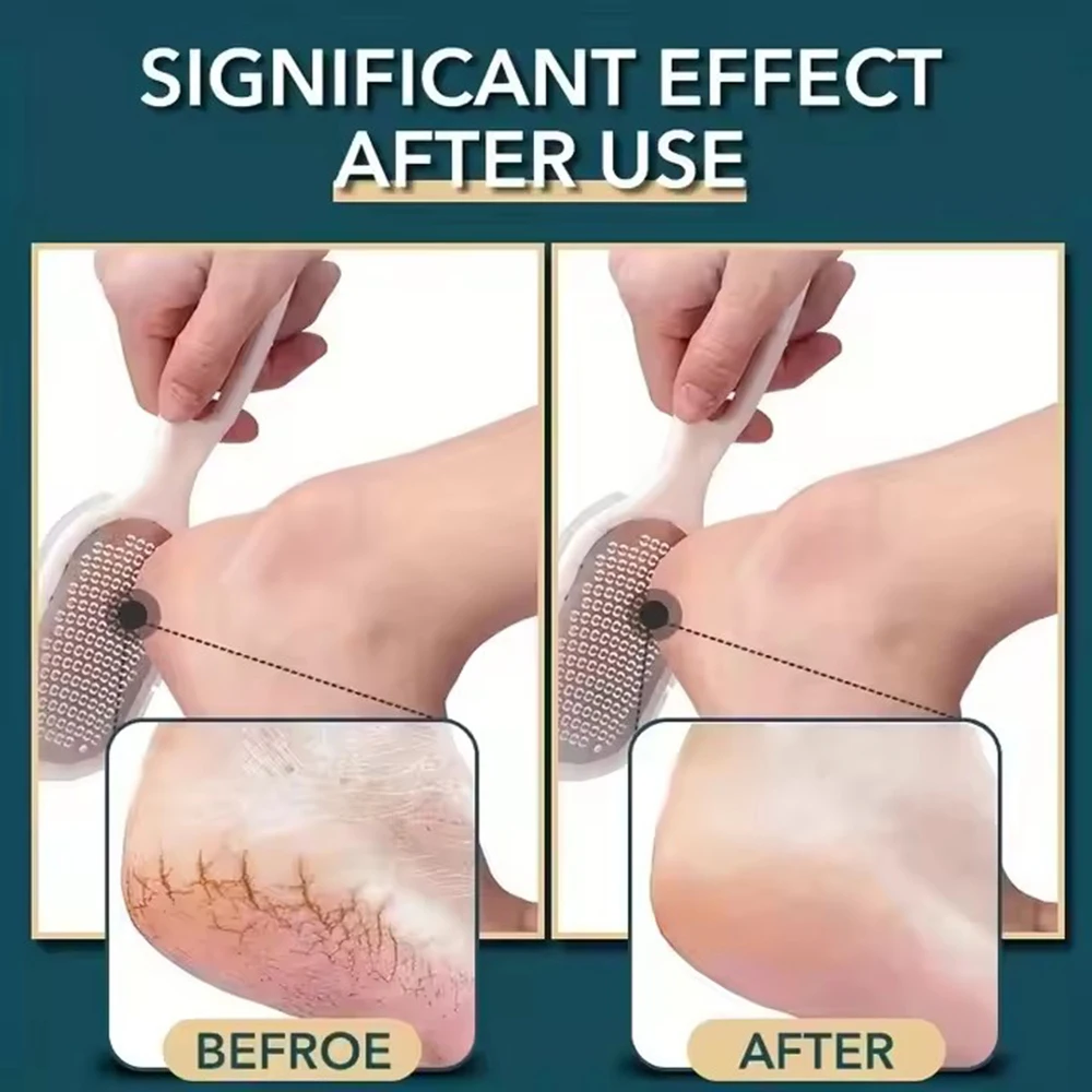 ملف القدم مزدوج الجانب المهنية الفولاذ المقاوم للصدأ ملف القدم الكالس مزيل قدم عرموش أداة العناية بالقدم مع غطاء #3