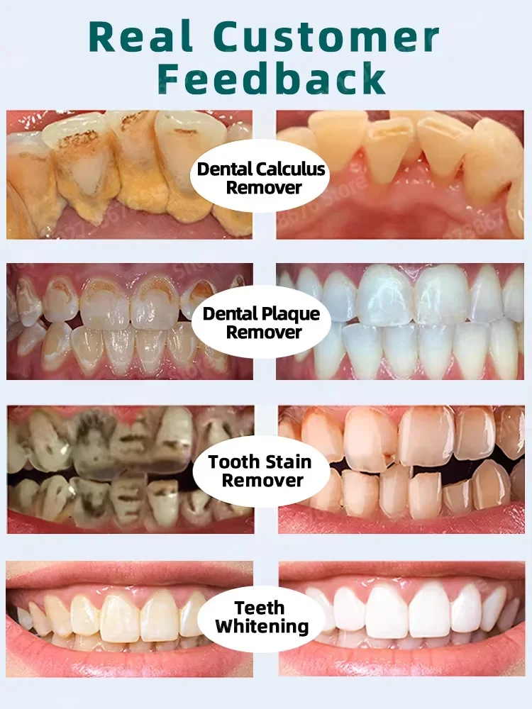 Limpieza de dientes tiene un efecto blanqueador, que es eficaz para manchas profundas, producto para el cuidado del blanqueamiento dental, regalos saludables