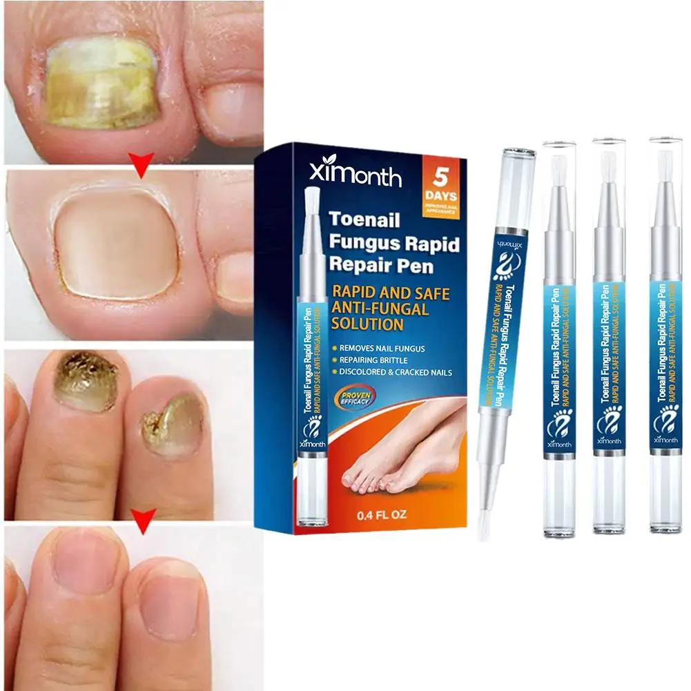 Stylo de thérapie des ongles, 12ml, onychomycose, paronyamitié, anti fongique, huile pour ongles, N64.Care, traitement des doigts, parka, outils de réparation, 4 pièces