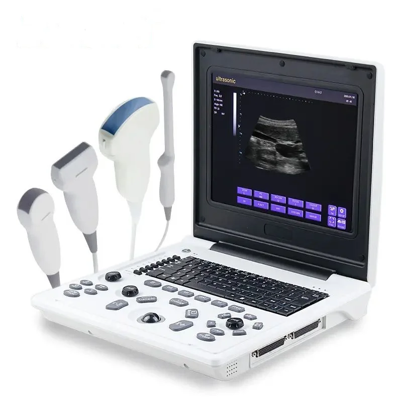 portable medical digital echocardiography instruments sonography ultrasonography laptop black and white  ultrasound Scanner USG