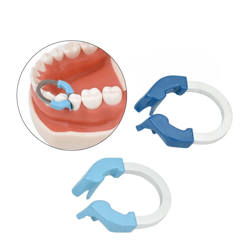 Dental NITI Matrix Bands Ring Garrison Style Matrix Clamp Clip Sectional Contoured Matrices Dentist Tool