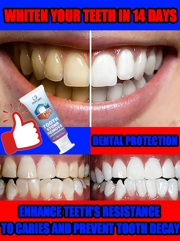 

Blueberry Flavor Toothpaste - Stain Removal, Teeth Whitening