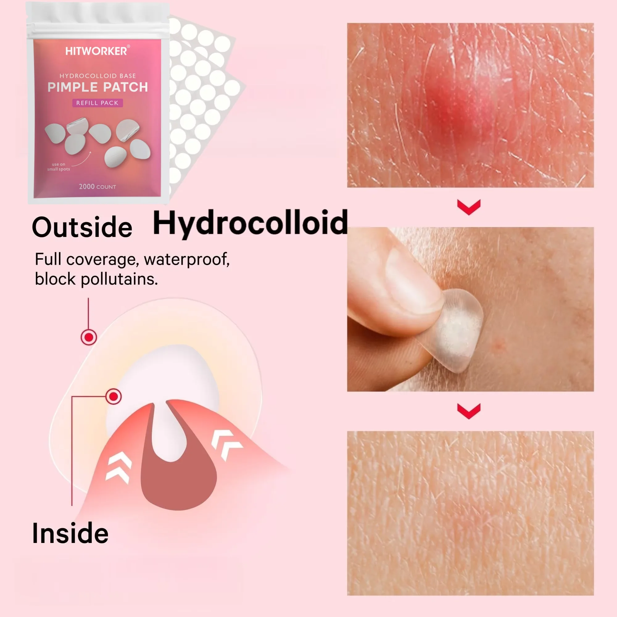 2000 PCS Invisible Acne Veneer Lump Sticker Reduce Acne Cleansing Pores Oil Removal Repair and Smooth Skin Facial Products