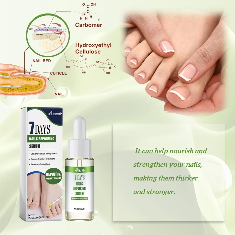 7DAYS Nail Fungus Treatment Liquid Serum Anti-Infection Onychomycosis Paronychia Hand Care Nails Foot Fungal Removal Gel 20ml