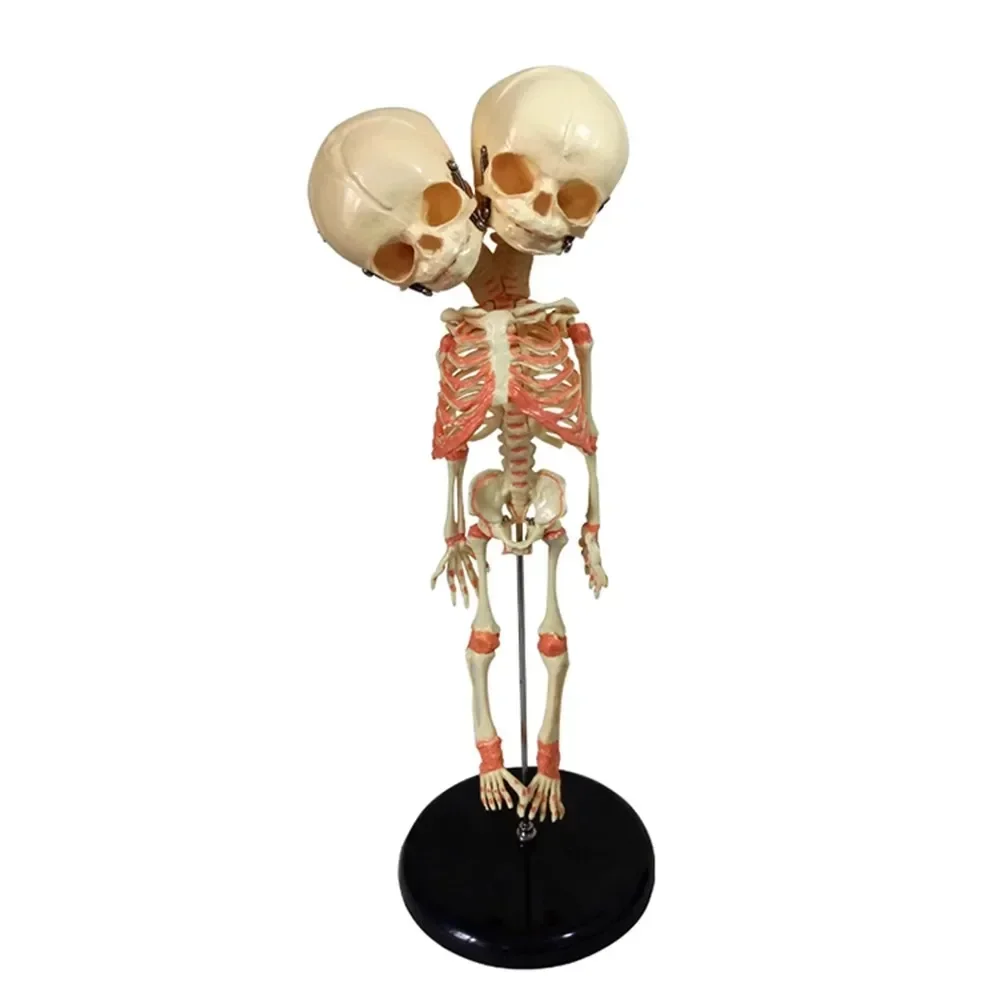 37cm Human Double Head Baby Skull Skeleton Anatomy Brain Display Study Teaching Anatomical Model Halloween Bar Ornament