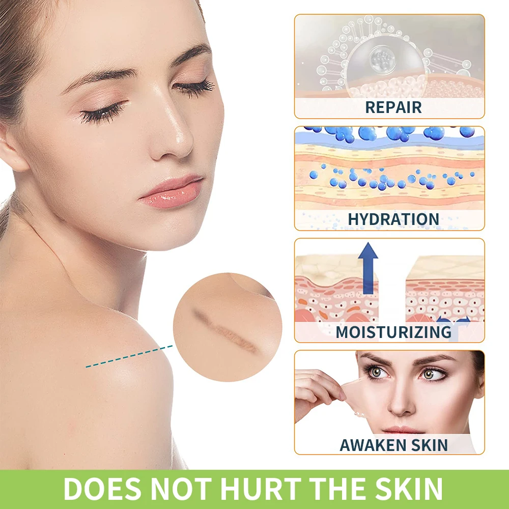 1.5/3M silikonowe plastry na blizny usuwanie niewidoczna podkładka korektorowa żelowa wodoodporna taśma leczenie do operacji cesarskiego oparzenia keloidowe podnoszenie brzucha